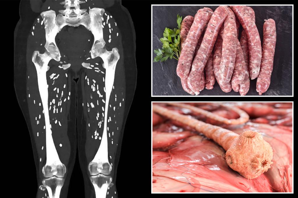 The gruesome body scan reveals a disturbing parasitic infection from undercooked pork